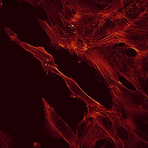 Adherent  mouse BALB/3T3 fibroblasts with phalloidin-stained actin filaments